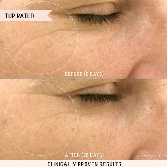 🌟$25 Biossance Squalane + Vitamin C Rose Oil - Picture 3 of 8